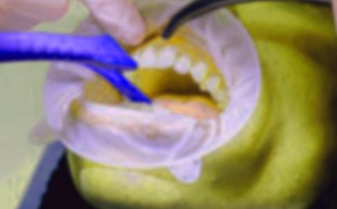 ����ӛ����(ͨ��15ƪ)