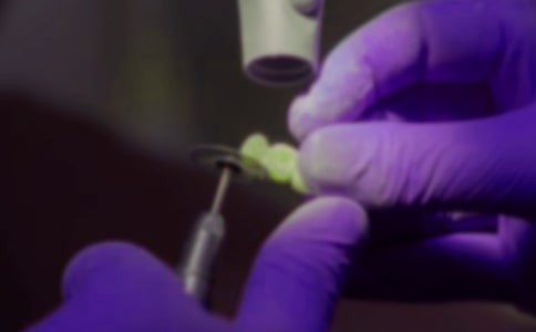 拔牙記敘事作文