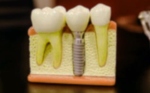 ����ӛ��(y��u)������200��