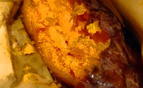 紅薯干熱量有多少