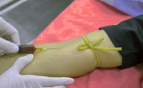 ����ܛ�M����iNOS�cOSAHS������ǻ�Mխ���P(gu��n)ϵ