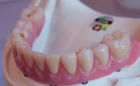 牙齦炎的保健常識(shí)